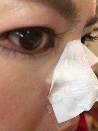让你的黑头离家出走,简单粗爆的粘掉它#好物推荐#黑头粉刺说拜拜#茶树油