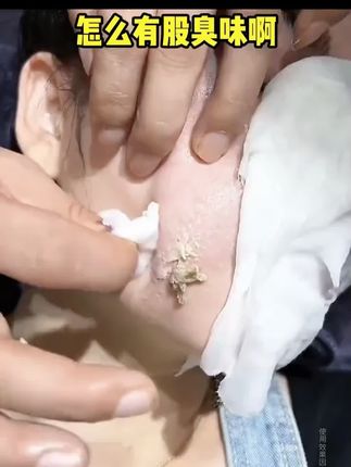 大数据它懂你的小心思,脸油有黑头粉刺痘痘和毛孔粗大的宝子赶快行动起来!皮肤好了颜值蹭蹭往上涨!#白云山#好物推荐