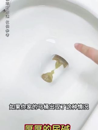 家里下水道每次洗澡都要扣一扣,可以试下这个管道疏通泡泡粉,倒上精致一段时间就可以了,不伤管道,超级好用。