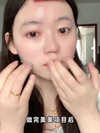 面膜选的好,面部没烦恼!这款美美面膜,让你项目无忧,改善肌肤的同时更加水润!#斐思妮#面膜