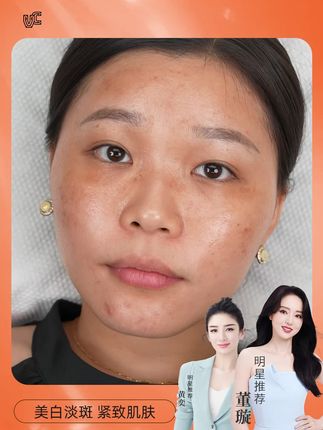 蕴含四大草本精华,美白淡斑,专为国人肌肤研制,厂家直销!