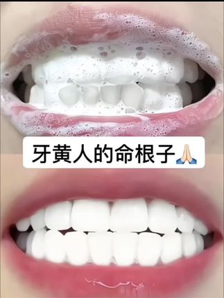 但凡你早点知道这个#美白牙膏 也不至于被#牙黄嘴臭 困扰这么多年,原来真的有可以去黄去渍的牙膏,快去试试吧