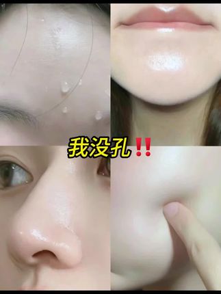 但凡早点知道这个,也不会被痘痘黑头粉刺困扰这么久了,脸上长痘,大油田,试试这个白云山泥膜棒,祛痘控油!#泥膜棒