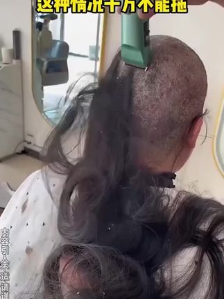 但凡你早点发现这个毛囊清洁喷雾,也不至于被困扰那么久!