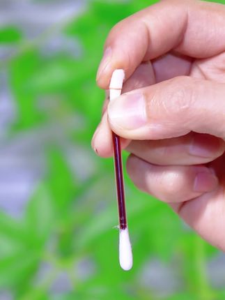 家里有小朋友的,一定要被上这款医用碘伏棉签,小伤擦伤都可以用来消毒。