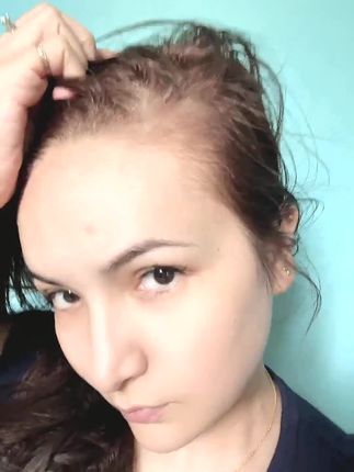 新疆乌斯曼草是真的可以!#逆袭 #万万没想到 #看过来 #内容太过真实 #前后对比