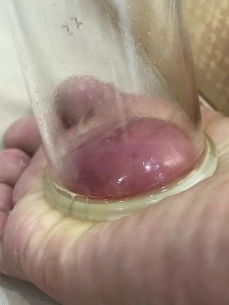 工作压力大,经常加班熬夜,睡前贴一贴百年思邈八珍足贴#好物推荐#国药医学