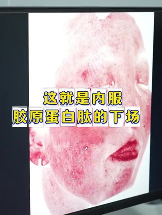 如果我18岁知道它,我从18岁就开始打卡 #内服胶原饮 #21金维他 #低价好物 #好物种草
