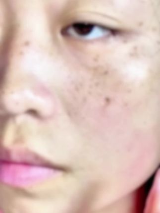 如果你脸上皮肤暗沉、斑斑点点、又黑又黄得不到改善,那你一定要试试这款,给自己一个变美的机会,保养就是要趁早
