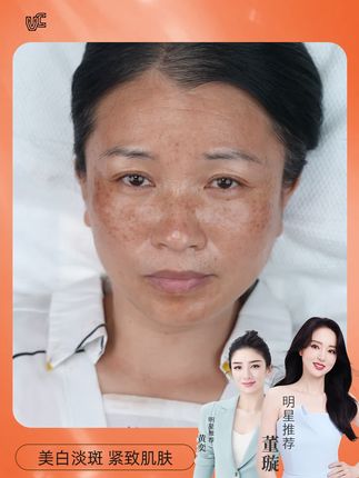 如果你脸上皮肤暗沉,不会化妆,又黑又黄得不到改善的,那你一定要试试这款 #美白淡斑霜B