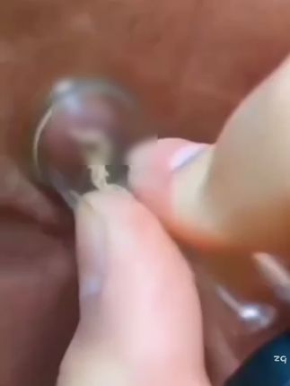 但凡你早点知道这个国货,也不至于被痘痘#黑头粉刺 困扰这么久,脸上长痘,大油田 试试这个#白云山清洁泥膜#护肤#洁面