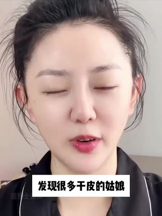 30岁终于悟了!养好皮肤才是精致感美女的必修课 #学会用酸 #好皮肤养出来 #果酸精华水 #湿敷