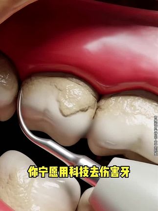 不管你是嘴巴不好闻,还是牙齿黑黄,都可以试试这款#宫教授亮白口气清新牙膏