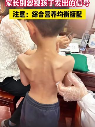 妈妈可以什么都不给孩子买,但一定要备上这款仁和牛脾肽鸡内金软糖!饭前两粒,孩子吃的放心~#宝宝辅食