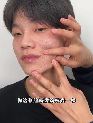 但凡你早点知道这个#国货,也不至于被#黑头#闭口粉刺困扰这么多年!原来素颜掐出水是这种感觉#敏感肌#氨基酸洗面奶
