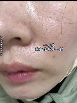 青春期孩子脸部护理很重要 这款氨基酸洗面奶 给孩子用正合适 #人类幼崽成长记#一花一个新世界#挖到换季性价比宝藏了