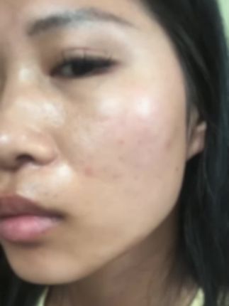 学会给毛孔洗澡,皮肤都会变好 #洗面奶 #洗卸合