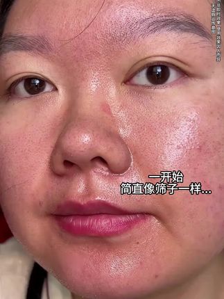 大数据是懂你们的 黑头 闭口 毛孔大的都去用它#亲测分享 #泥膜棒