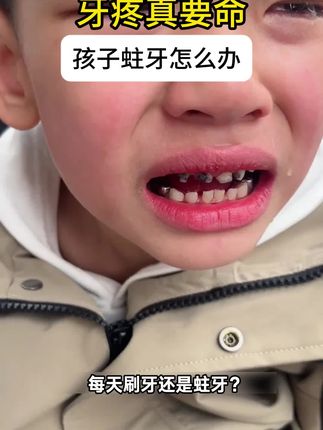 给牙齿穿 “软毛衣”!这款软毛刷头电动牙刷,宝宝用了就离不开~#儿童电动牙刷 #儿童礼物# 艾优电动牙刷