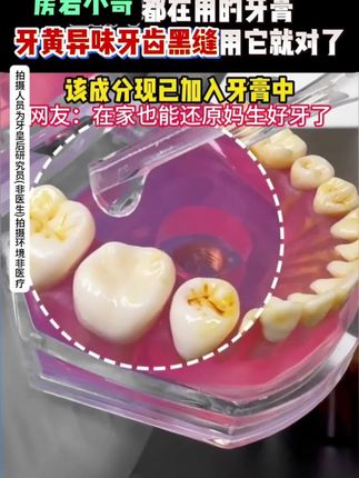 但凡你早点知道这个#美白牙膏 也不至于被#牙黄嘴臭 困扰这么久,原来真的有可以去黄去渍的牙膏,快去试试吧